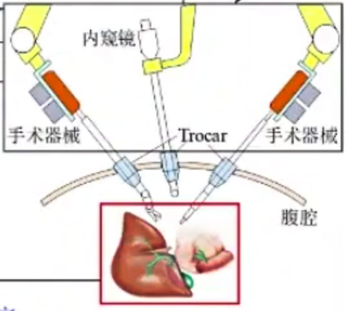腹腔鏡手術機器人結(jié)構(gòu)設計原理—AIP艾普